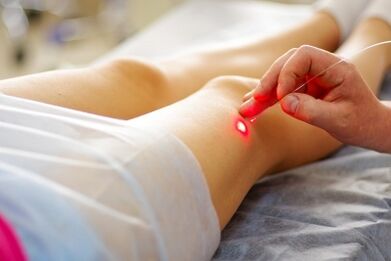 Terapia con láser